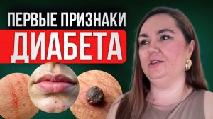 Как предотвратить развитие сахарного диабета?  / Как понять что у вас диабет?