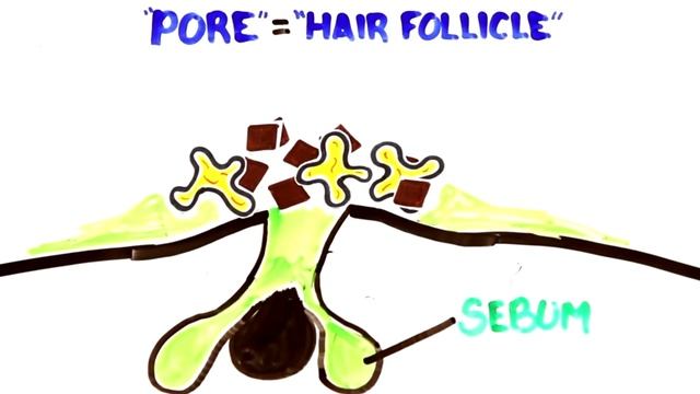 How To Get Rid of a Pimple In One Day | Homemade Pimple & Acne Treatment | Asad Ansari смотреть онлайн