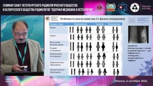 Трехфазная остеосцинтиграфия с ОФЭКТ/КТ. Роль в диагностике костной патологии.