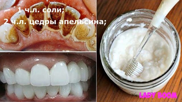 Всего за 2 Минуты отбеливание зубов в домашних условиях / КАК ОТБЕЛИТЬ ЗУБЫ В ДОМАШНИХ УСЛОВИЯХ смотреть онлайн