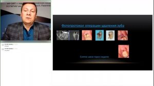 Фотопротокол - современный инструмент ведения мед. документации и междисциплинарного взаимодействия