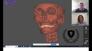 Цифровой сплинт. Взаимодействие зубного техника и врача