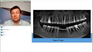 Основы взаимодействия ортодонта и пародонтолога