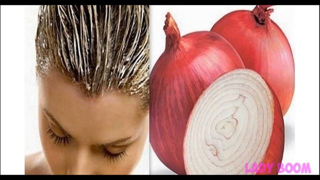 Это МАСЛО дает ЭКСТРЕМАЛЬНЫЙ рост ВОЛОС ✔️ Уход за волосами в домашних условиях ✔️ смотреть онлайн