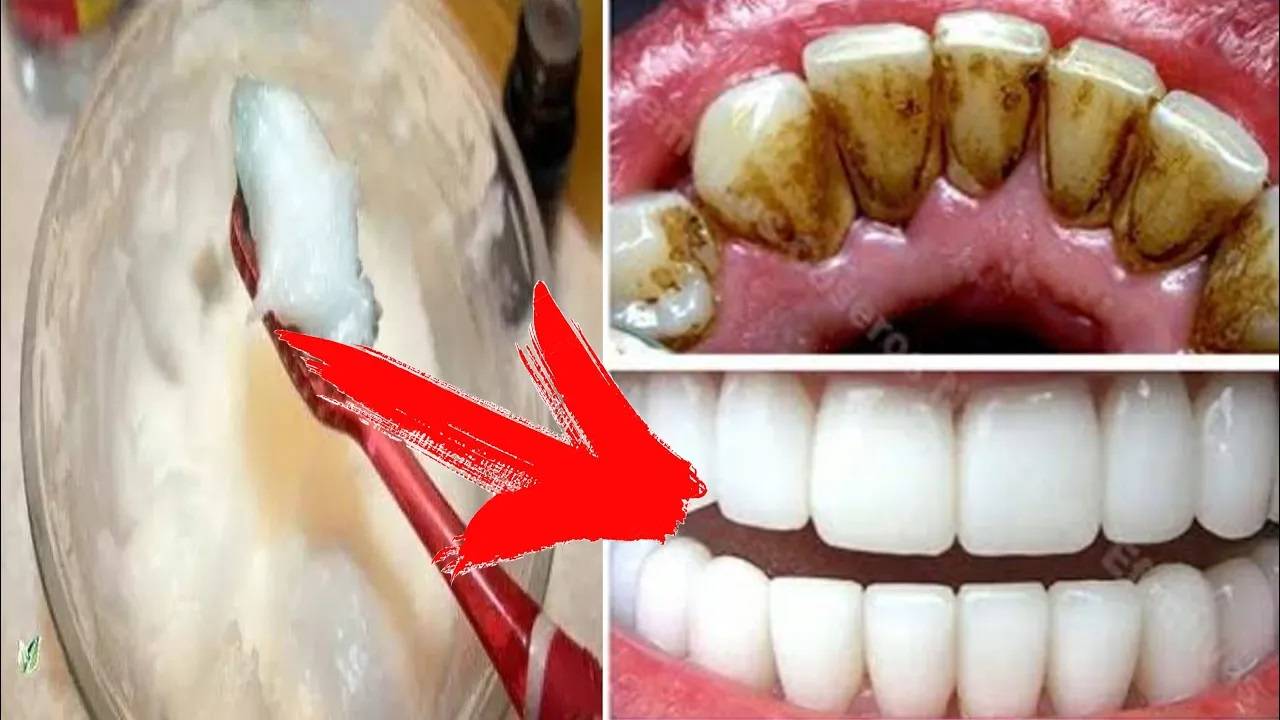 отбеливание зубов в домашних условиях за 2 минуты / обзор для естественного отбеливания желтых зубов смотреть онлайн