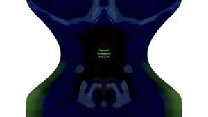 Blind And Deaf Klasky Csupo Effects 2