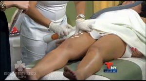 Buenos Dias New York:  Cellulite Reduction