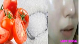 КАК ОТБЕЛИТЬ КОЖУ ЛИЦА ЗА 10 МИНУТ В ДОМАШНИХ УСЛОВИЯХ