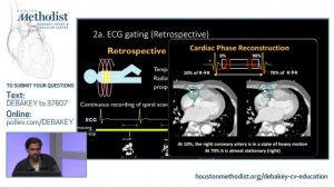 Dynamic Imaging for Aortic Dissections (Alan B. Lumsden, MD, Ponraj Chinnadurai, MBBS) May 11, 2021