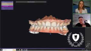 Клинический и лабораторный этап изготовления окклюзионных накладок