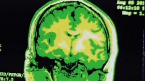 Нарушение режима сна повышает смертность в 2 раза