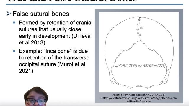Inconsistent Identification of Sutural Traits in Anthropology and Medicine смотреть онлайн