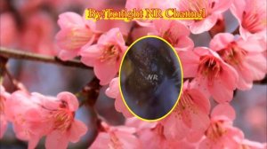 ear wax removal satisfying || earwax extractions || earwax microsection || ear wax removal asmr