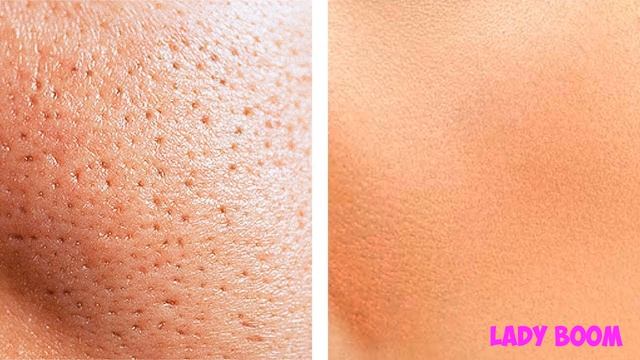 ЭФФЕКТИВНО вы БУДИТЕ в ШОКЕ! ИСПОЛЬЗУЙТЕ яйцо ТАКИМ ОБРАЗОМ, получите Фарфоровую кожу- ботокс смотреть онлайн