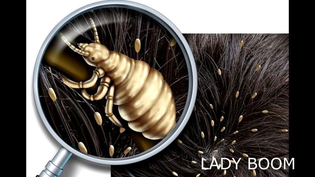 Насекомые не выносят «тройного»...Как Быстро Избавиться от Вшей и Гнид в Домашних Условиях. смотреть онлайн