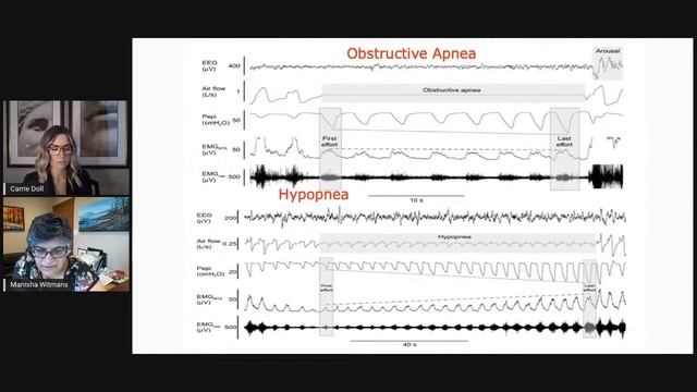 Understanding the AHI Conundrum for Diagnosis and Follow-up Treatment of Sleep Apnea