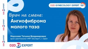 Врач на смене: Ангиофиброма малого таза