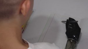 Как живёт Ильназ Давлетов, потерявший руки от удара электрическим током