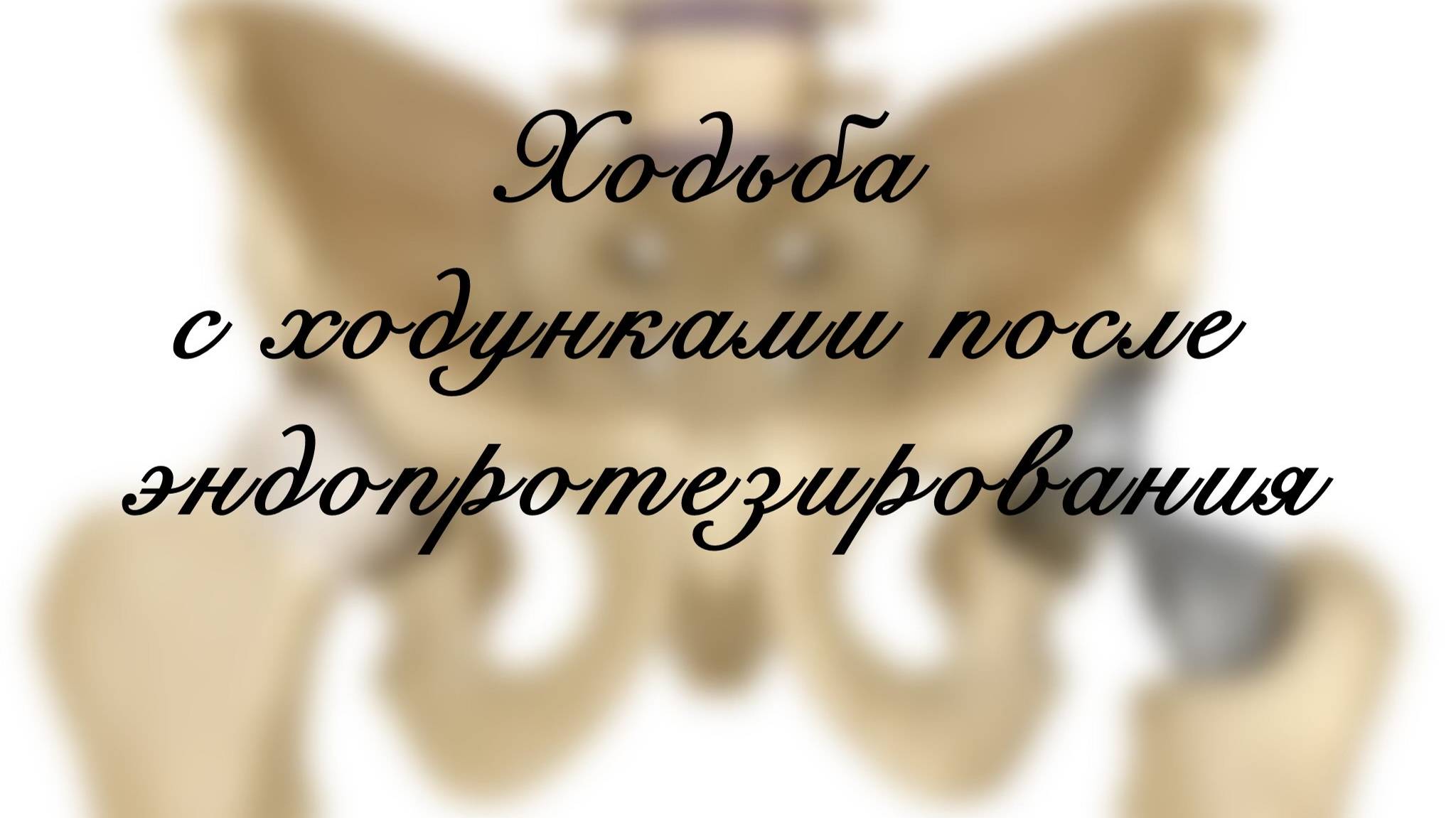 Ходьба с ходунками после эндопротезирования