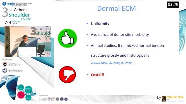 Superior capsule reconstruction. Is it a revolution? - Giuseppe Milano смотреть онлайн