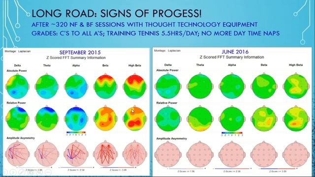 Jay Gunkelman - Epilepsy and the Foundations of NFB смотреть онлайн