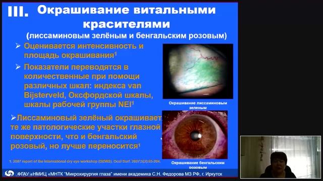 Синдром красного глаза (синдром сухого глаза)