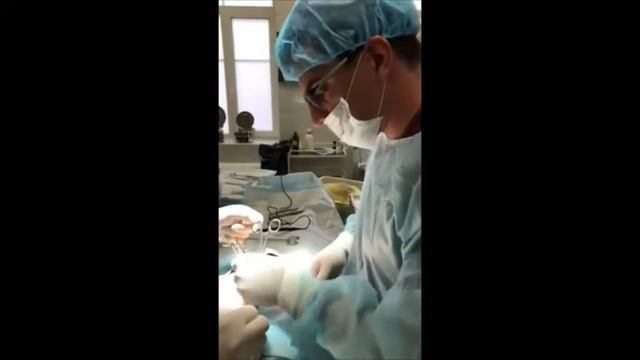 Удаление пупочной грыжи с применением сетчатого импланта Ventralex BARD