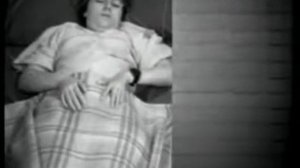 Парциальный моторный эпилептический приступ