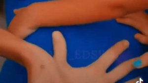 - Толкается малыш Эды и Серкана😍💞🥺