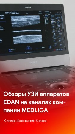 Обзоры ультразвуковых портативных аппаратов EDAN