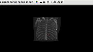 MedPac Systems web based 3D dicom viewer for Teleradiology and PACS