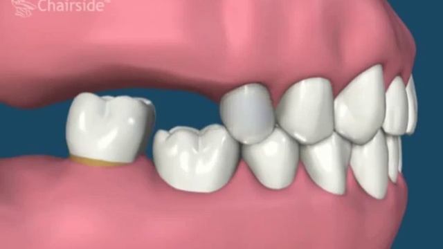 5 5 Прорезывание нижних зубов при отсутствии верхних