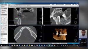 Компьютерная томография зубов в спб