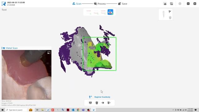 QuickScan IOS By Runyes Implant Workflow