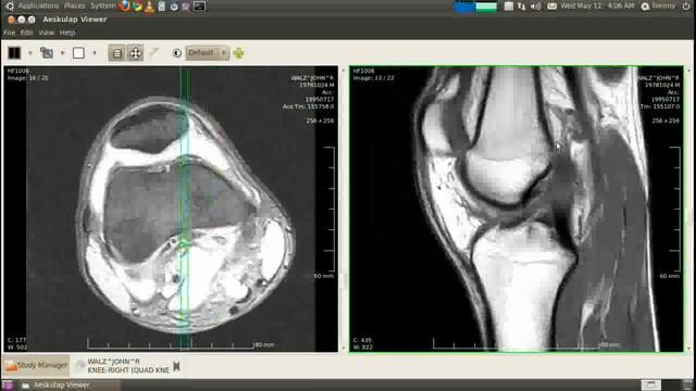 DICOM on Linux (Ubuntu)
