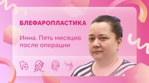 Инна. Верхняя блефаропластика. 5 месяцев после операции