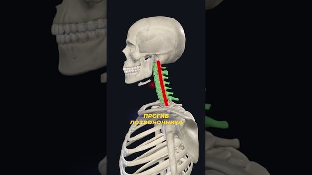 Проблемы с шеей из детства!