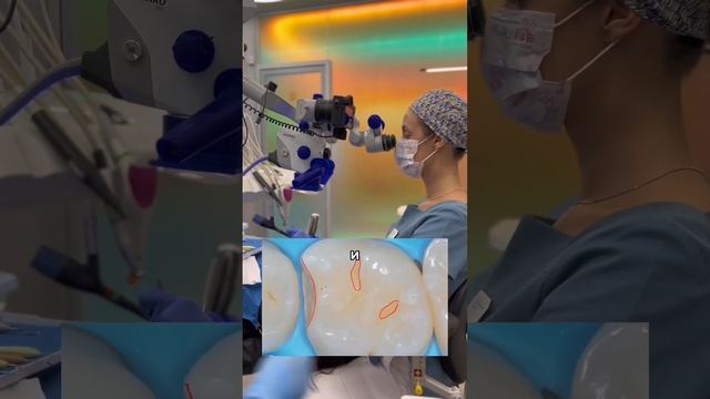 ⚡ Микрокариес. Искусство реставрации