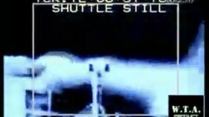 Epilepsy Bout - Wnen The Big Fight Going On