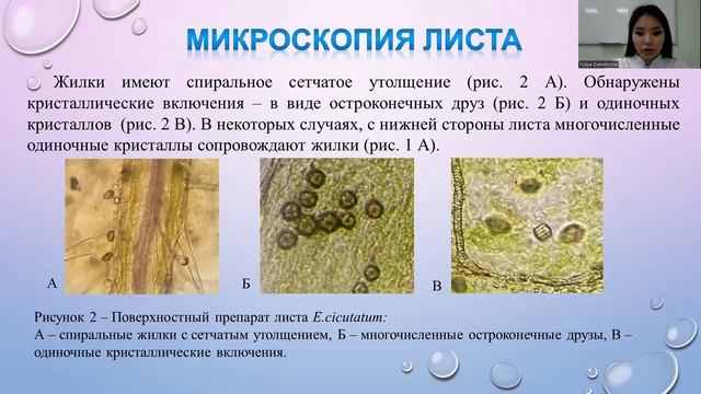 12. ОСОБЕННОСТИ СТРОЕНИЯ НАДЗЕМНЫХ И ПОДЗЕМНЫХ ОРГАНОВ ЖУРАВЕЛЬНИКА ЦИКУТОВОГО