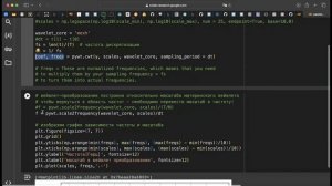 6 - частотный анализ временных рядов ЭЭГ пример