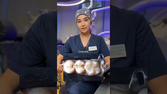 Скрытый кариес! Сохраняем зубы живыми и крепкими