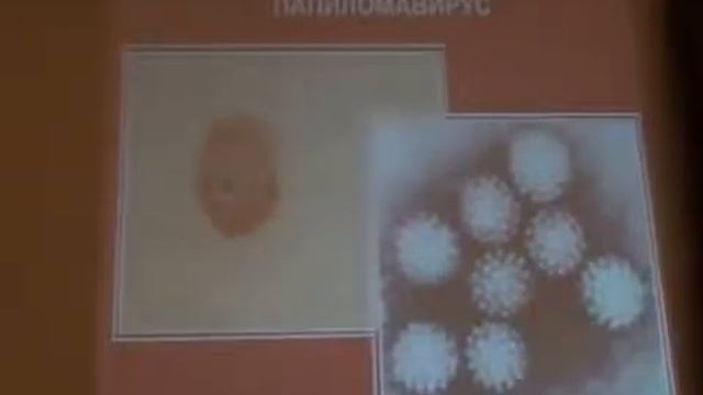 Вирусные заболевания. Вирус герпеса, Папиллома вирус и др. О.А. Бутакова.