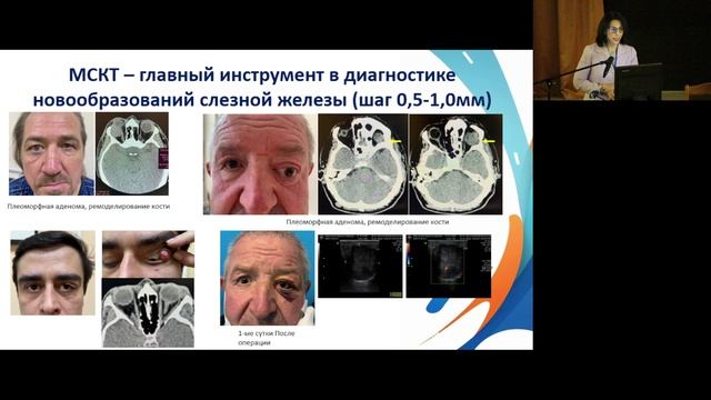 Научно-практическая конференция «Онконастороженность в практике врача-офтальмолога»