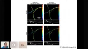 Jakob Macke: Training Neural Networks to Identify Mechanistic Models of Neural Networks