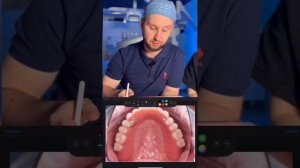 Что делать при полной потере зубов? Решение от команды врачей Belgravia Dental Studio