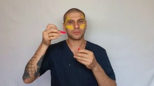 7.4. Лифтинг верхнего века, тейпирование