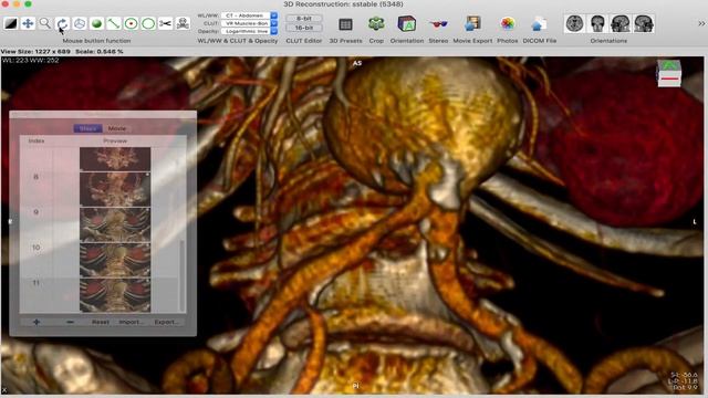 TUTORIEL  du logiciel HOROS
