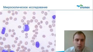 Острый миеломоноцитарный лейкоз