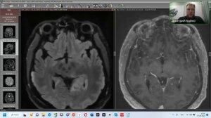 Практикум по нейрорадиологии (1 занятие)